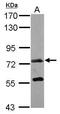 Polypeptide N-Acetylgalactosaminyltransferase 7 antibody, GTX119421, GeneTex, Western Blot image 