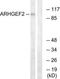 Rho/Rac Guanine Nucleotide Exchange Factor 2 antibody, TA314873, Origene, Western Blot image 