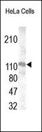 hTERT antibody, 251905, Abbiotec, Western Blot image 