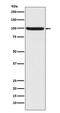Nuclear Factor, Erythroid 2 Like 2 antibody, P00078, Boster Biological Technology, Western Blot image 