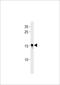 NADH:Ubiquinone Oxidoreductase Complex Assembly Factor 3 antibody, LS-C203958, Lifespan Biosciences, Western Blot image 