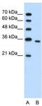 Phosphoribosyl Pyrophosphate Synthetase 2 antibody, TA346093, Origene, Western Blot image 