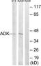 Adenosine Kinase antibody, TA313431, Origene, Western Blot image 