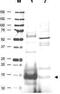 Ubiquitin Conjugating Enzyme E2 N antibody, GTX48485, GeneTex, Western Blot image 