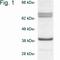 Biliverdin Reductase A antibody, NB120-3466, Novus Biologicals, Western Blot image 