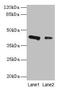 RAD23 Homolog B, Nucleotide Excision Repair Protein antibody, CSB-PA019260LA01HU, Cusabio, Western Blot image 