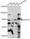 Cyclic Nucleotide Gated Channel Alpha 4 antibody, LS-C749702, Lifespan Biosciences, Western Blot image 