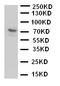 P2X purinoceptor 7 antibody, PA2129, Boster Biological Technology, Western Blot image 