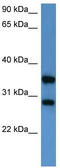 Serine/threonine/tyrosine-interacting-like protein 1 antibody, TA342934, Origene, Western Blot image 