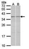 TGFB Induced Factor Homeobox 2 antibody, orb73557, Biorbyt, Western Blot image 
