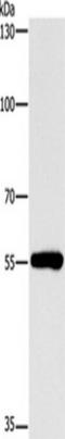 Cytochrome P450 Family 46 Subfamily A Member 1 antibody, TA351117, Origene, Western Blot image 