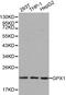Glutathione Peroxidase 1 antibody, LS-C192311, Lifespan Biosciences, Western Blot image 