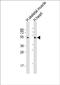 Rhomboid Like 1 antibody, PA5-49484, Invitrogen Antibodies, Western Blot image 