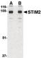 Stromal Interaction Molecule 2 antibody, LS-B1262, Lifespan Biosciences, Western Blot image 