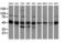 Protein kinase C and casein kinase substrate in neurons protein 3 antibody, LS-C172556, Lifespan Biosciences, Western Blot image 