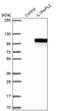 Interleukin 1 Receptor Accessory Protein Like 2 antibody, PA5-57531, Invitrogen Antibodies, Western Blot image 