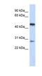 Laccase Domain Containing 1 antibody, NBP1-56736, Novus Biologicals, Western Blot image 