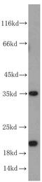 SUB1 Regulator Of Transcription antibody, FNab08367, FineTest, Western Blot image 
