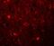 Sushi Repeat Containing Protein X-Linked antibody, GTX31394, GeneTex, Immunohistochemistry paraffin image 