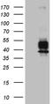 V-set domain-containing T-cell activation inhibitor 1 antibody, M02821, Boster Biological Technology, Western Blot image 
