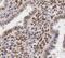 Thymidylate Synthetase antibody, FNab08681, FineTest, Immunohistochemistry frozen image 