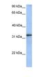ADP Ribosylation Factor Like GTPase 13B antibody, orb330697, Biorbyt, Western Blot image 