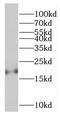 Neurocalcin Delta antibody, FNab05572, FineTest, Western Blot image 