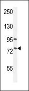 Arachidonate 12-Lipoxygenase, 12R Type antibody, 55-035, ProSci, Western Blot image 