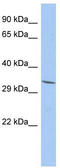 Family With Sequence Similarity 78 Member A antibody, TA333582, Origene, Western Blot image 