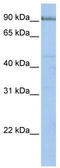 Protocadherin Alpha 5 antibody, TA331059, Origene, Western Blot image 