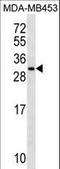 Mitochondrial Ribosomal Protein S10 antibody, LS-C158306, Lifespan Biosciences, Western Blot image 