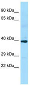 Solute Carrier Family 35 Member D2 antibody, TA333899, Origene, Western Blot image 