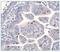 Lin-28 Homolog A antibody, NBP1-49537, Novus Biologicals, Immunohistochemistry paraffin image 