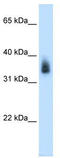 MAGE Family Member A8 antibody, TA346404, Origene, Western Blot image 