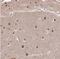 ST18 C2H2C-Type Zinc Finger Transcription Factor antibody, NBP1-92445, Novus Biologicals, Immunohistochemistry frozen image 