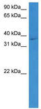 Steap antibody, TA341709, Origene, Western Blot image 
