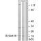 Protein S100-A16 antibody, A08032, Boster Biological Technology, Western Blot image 