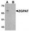 Zinc finger CCCH-type with G patch domain-containing protein antibody, TA320054, Origene, Western Blot image 