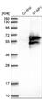 Caspase Activity And Apoptosis Inhibitor 1 antibody, NBP1-94018, Novus Biologicals, Western Blot image 