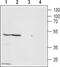 Zinc Activated Ion Channel antibody, PA5-77765, Invitrogen Antibodies, Western Blot image 