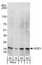 Superoxide Dismutase 1 antibody, A303-811A, Bethyl Labs, Western Blot image 