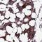 Coiled-Coil Domain Containing 183 antibody, PA5-60521, Invitrogen Antibodies, Immunohistochemistry frozen image 