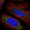 SPINK5 antibody, PA5-52820, Invitrogen Antibodies, Immunofluorescence image 