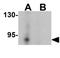 Lysine-specific histone demethylase 1B antibody, GTX32122, GeneTex, Western Blot image 