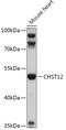 Carbohydrate Sulfotransferase 12 antibody, 18-070, ProSci, Western Blot image 