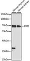 Perforin 1 antibody, MBS125682, MyBioSource, Western Blot image 