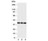 Integrin Binding Sialoprotein antibody, R30987, NSJ Bioreagents, Western Blot image 