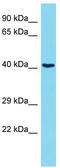 Rho Guanine Nucleotide Exchange Factor 39 antibody, TA333600, Origene, Western Blot image 