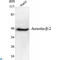 ARRB2 antibody, LS-C814095, Lifespan Biosciences, Immunofluorescence image 