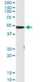 Carboxypeptidase B1 antibody, LS-C133130, Lifespan Biosciences, Immunoprecipitation image 